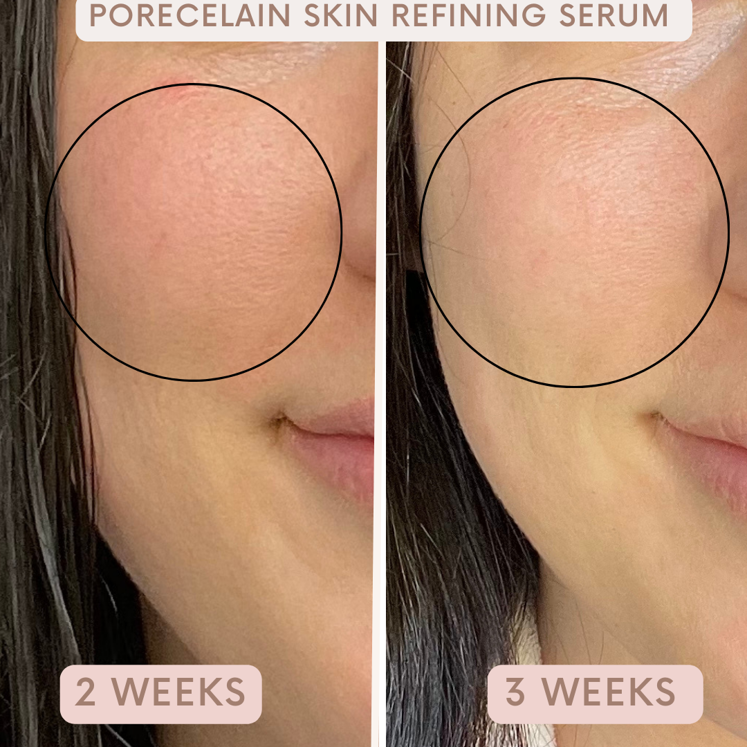 Porecelain™ Skin Refining Serum