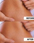 Stretch Mark Eraser